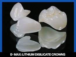 services, Crown & Bridge, mid , E MAX Lithium Disilicate Crowns