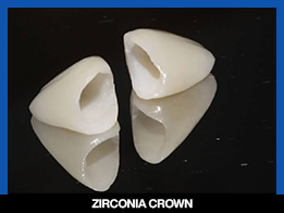 services, Crown & Bridge, mid , Zirconia Crown