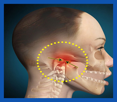 services, Management of Jaw Disorder Pain, top right image