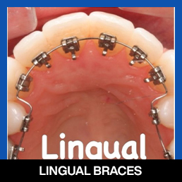 services, Orthodontic Treatment, Dental Braces, bottom 2nd image