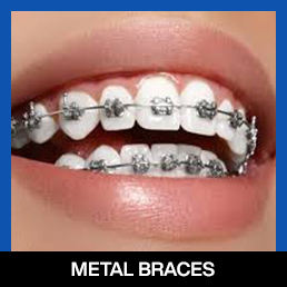 services, Orthodontic Treatment, Dental Braces, left first image