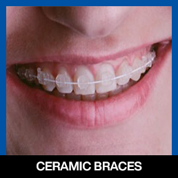 services, Orthodontic Treatment, Dental Braces, right 3rd image (new)