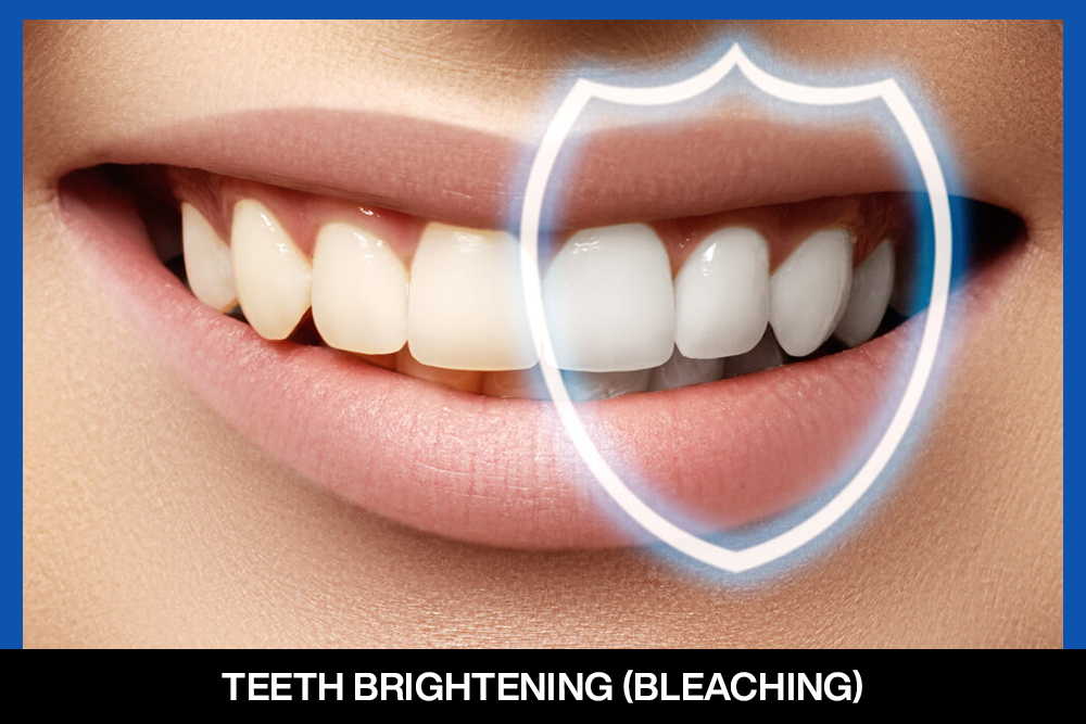 https://www.pearldentlko.com/wp-content/uploads/2024/08/services-cosmetic-dentist-teeth-brightning-image.jpg